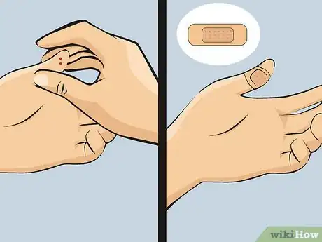 Image intitulée Pull a Fish Hook from Your Finger Step 5