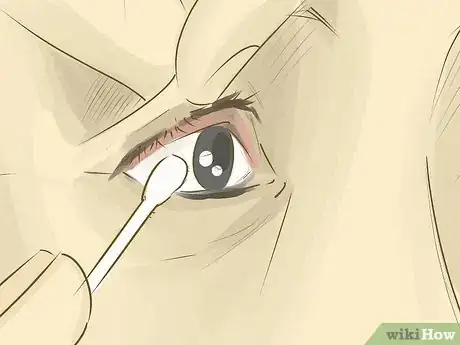 Image intitulée Remove Something from Your Eye Step 6