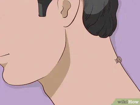 Image intitulée Remove a Skin Tag from Your Neck Step 12