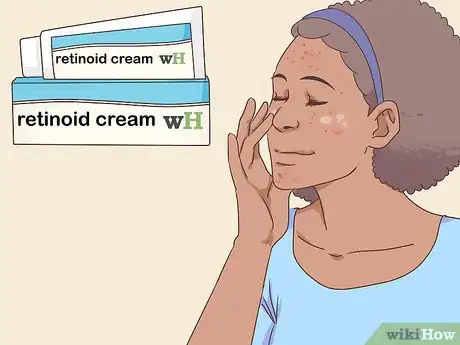 Image intitulée Get Rid of Acne Fast Step 4
