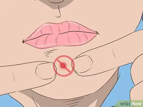 Image intitulée Recognize Staph Infection Symptoms Step 5