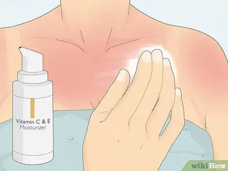 Image intitulée Take Care of Your Skin After Using a Tanning Bed Step 15