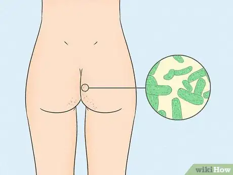 Image intitulée Get Rid of Acne on the Buttocks Step 1