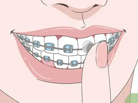 Image intitulée Eat Food With New or Tightened Braces Step 8