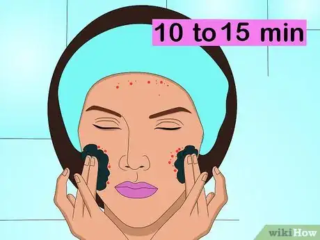Image intitulée Get Rid of Acne Scabs Fast Step 8