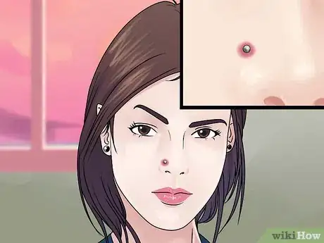 Image intitulée Care for Your Nose Piercing Step 15