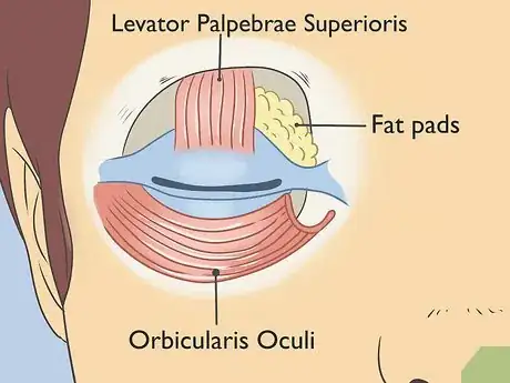 Image intitulée Treat Droopy Eyelids Step 6