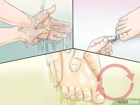 Image intitulée Prevent the Spread of Fungal Infections Step 14