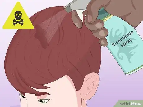 Image intitulée Prevent Lice Step 5