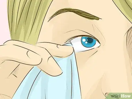 Image intitulée Remove Something from Your Eye Step 7