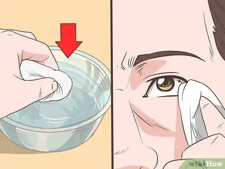 Image intitulée Remove Something from Your Eye Step 5