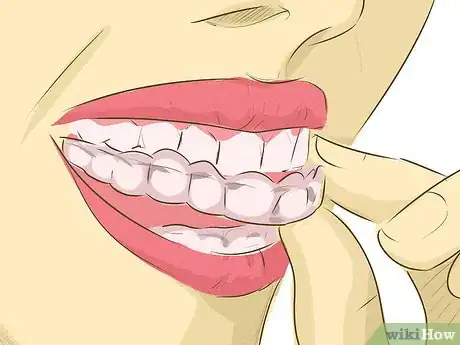 Image intitulée Whiten Teeth Step 8