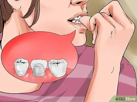 Image intitulée Avoid Dental Crown Problems Step 13