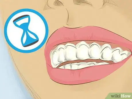 Image intitulée Whiten Teeth Step 9