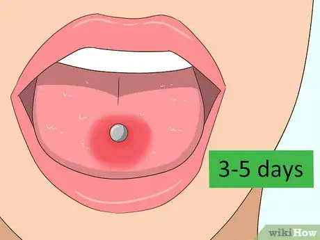 Image intitulée Reduce Tongue Swelling Step 9