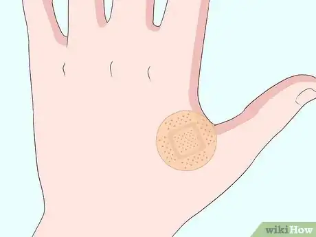 Image intitulée Stop Warts from Bleeding Step 4