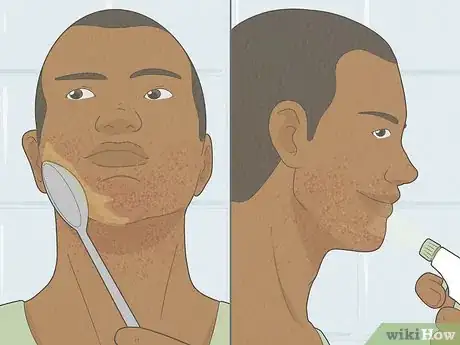 Image intitulée Get Rid of Razor Burn Fast Step 3