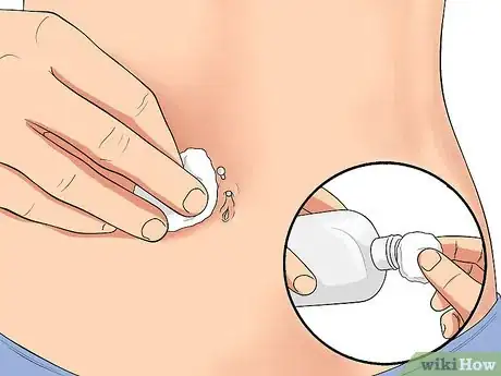Image intitulée Treat an Irritated Belly Button Piercing Step 1