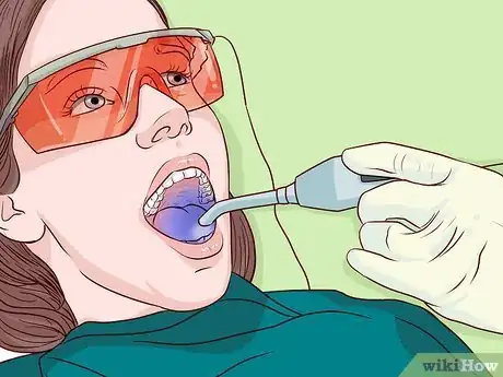 Image intitulée Whiten Teeth with Natural Methods Step 13