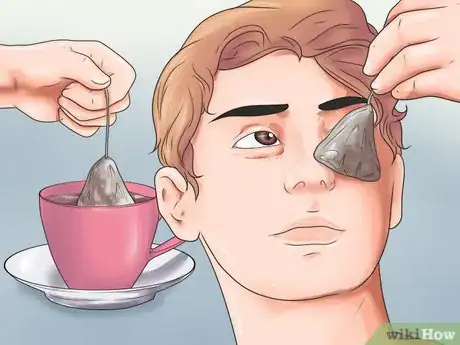 Image intitulée Get Rid of Bags Under Your Eyes Step 4