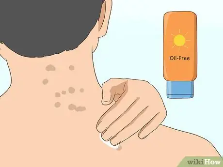 Image intitulée Get Rid of Back Acne Scars Step 2