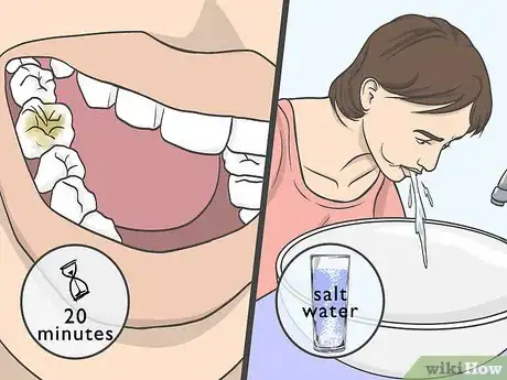 Image intitulée Use Clove Oil for Tooth Pain Step 3