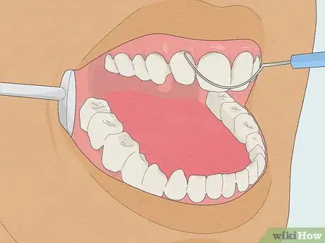 Image intitulée Fix Rotting Teeth Step 11