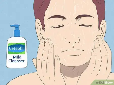 Image intitulée Get Rid of Acne if You Have Fair Skin Step 14