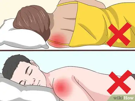 Image intitulée Sleep with Rotator Cuff Pain Step 4