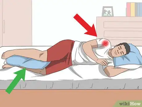 Image intitulée Sleep with Rotator Cuff Pain Step 2