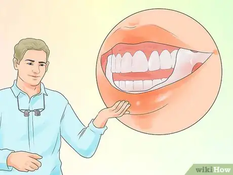 Image intitulée Cure Bruxism Step 12