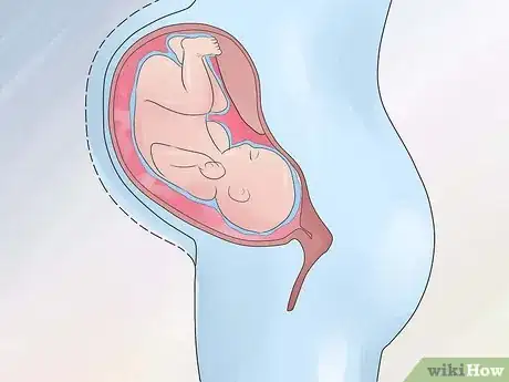 Image intitulée Increase Amniotic Fluid Step 14