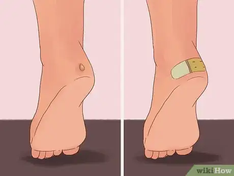 Image intitulée Have Flawless Feet Step 7