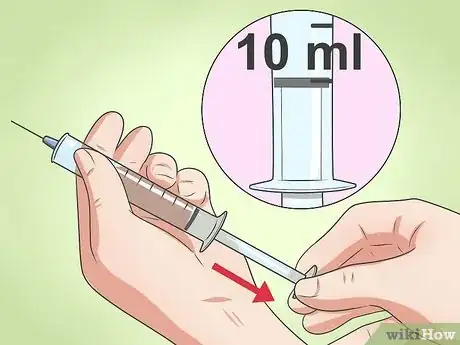 Image intitulée Irrigate a Foley Catheter Step 4