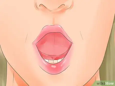 Image intitulée Cure Bruxism Step 11