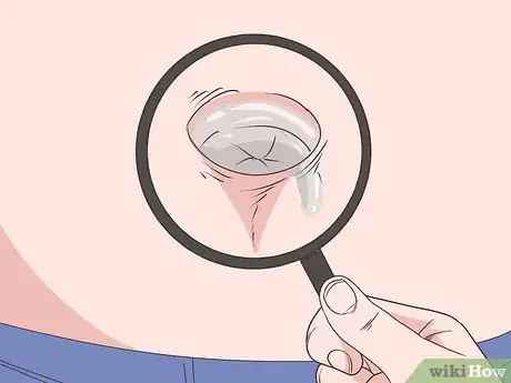 Image intitulée Treat an Infection in Your Belly Button Step 1