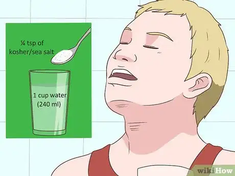 Image intitulée Reduce Tongue Swelling Step 5