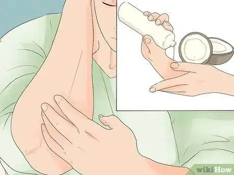 Image intitulée Treat Eczema Naturally Step 12