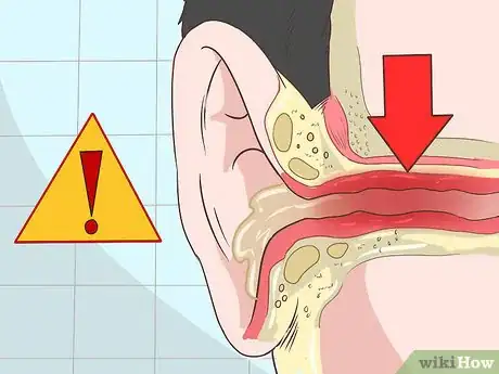 Image intitulée Get Rid of Ear Wax Step 1