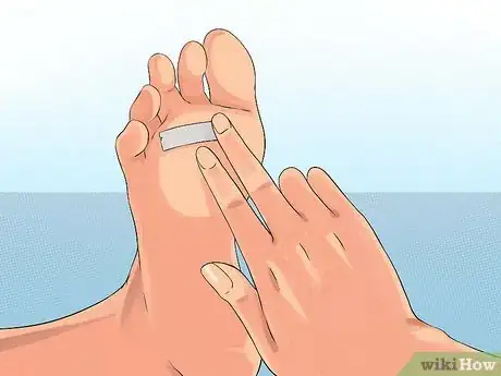 Image intitulée Get Rid of Plantar Warts (Verrucas) Step 4