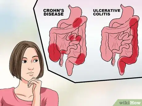 Image intitulée Recognize the Symptoms of Inflammatory Bowel Disease Step 15