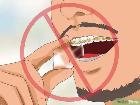 Image intitulée Get Your Braces off Faster Step 10