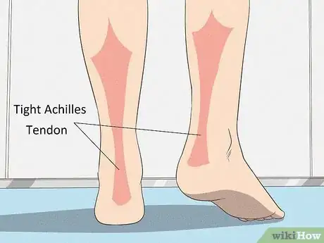Image intitulée Fix Flat Feet Step 2