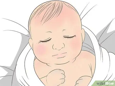 Image intitulée Know What to Expect on a Newborn's Skin Step 1