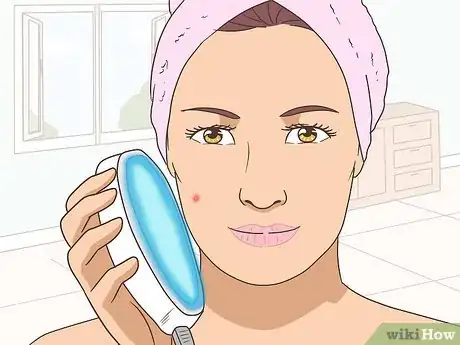 Image intitulée Get Rid of a Pimple Step 3