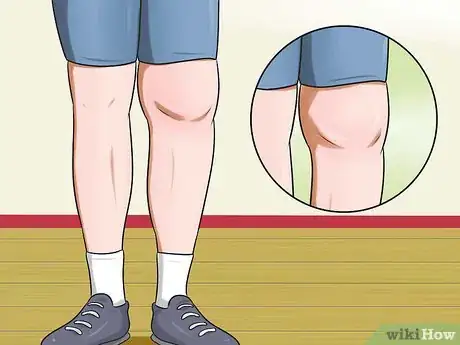 Image intitulée Know if You Have Arthritis in the Knee Step 5