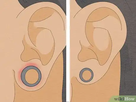 Image intitulée Stretch Your Ears Pain Free Step 10