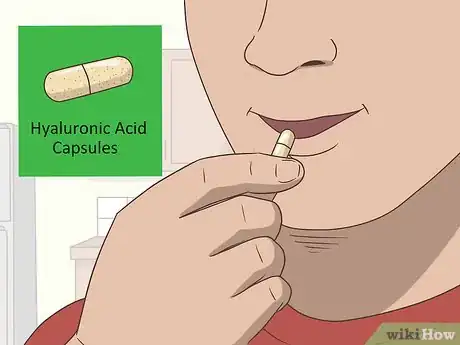 Image intitulée Increase Synovial Fluid Step 9