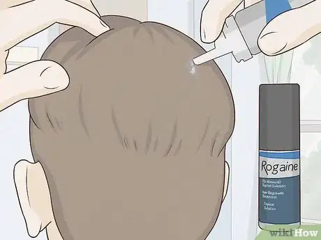 Image intitulée Regrow Hair Naturally Step 17