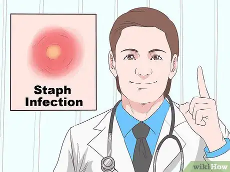 Image intitulée Recognize Staph Infection Symptoms Step 6